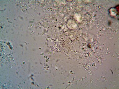 Mikroskop x100 'de görülen mikroorganizma