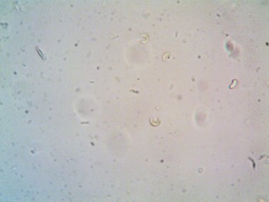 Mikroskop x100 'de görülen mikroorganizma