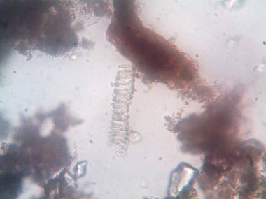 Mikroskop x100 'de görülen mikroorganizma