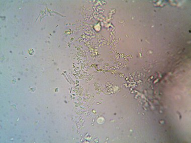 Mikroskop x100 'de görülen mikroorganizma