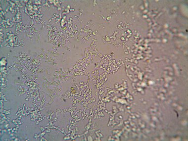 Mikroskop x100 'de görülen mikroorganizma