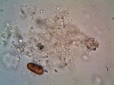 Mikroskop x100 'de görülen mikroorganizma
