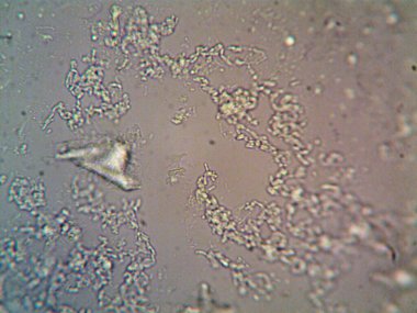 Mikroskop x100 'de görülen mikroorganizma