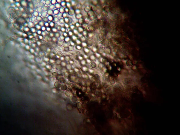 Mikroorganizm Widziany Mikroskopie X100 — Zdjęcie stockowe