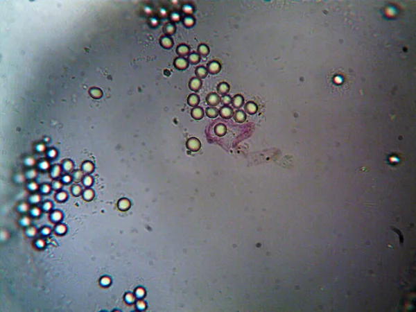 Μικροοργανισμός Στο Μικροσκόπιο X100 — Φωτογραφία Αρχείου