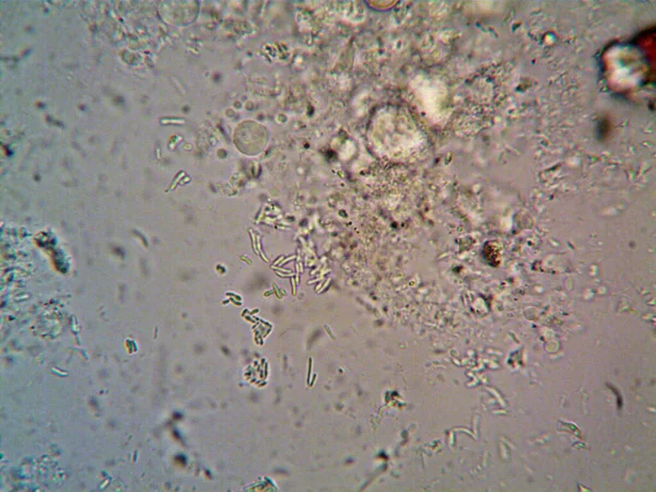 Mikroskop X100 Görülen Mikroorganizma — Stok fotoğraf