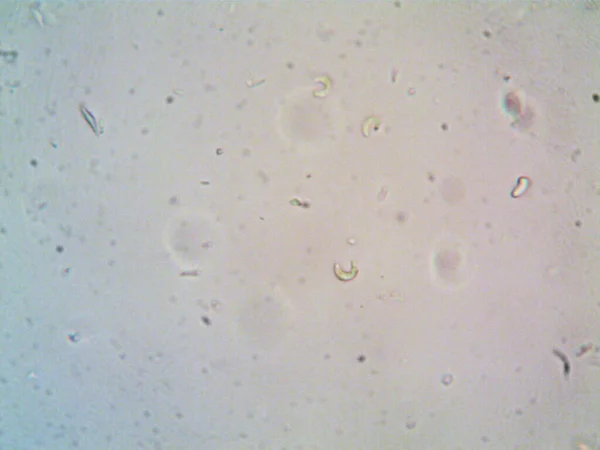 Mikroskop x100 'de görülen mikroorganizma