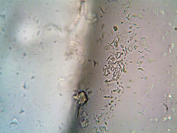 Microorganism Seen Microscope X100 — Stock Photo, Image