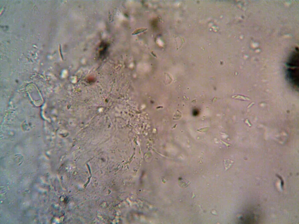 Micro Organisme Waargenomen Microscoop X100 — Stockfoto