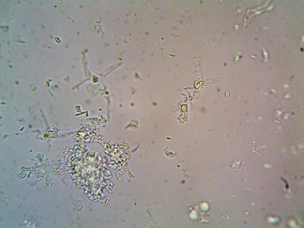 显微镜下的微生物X100 — 图库照片
