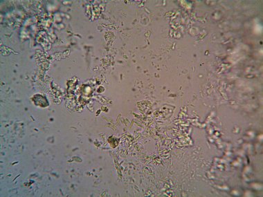 Mikroskop x100 'de görülen mikroorganizma