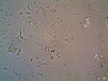 Mikroskop x100 'de görülen mikroorganizma