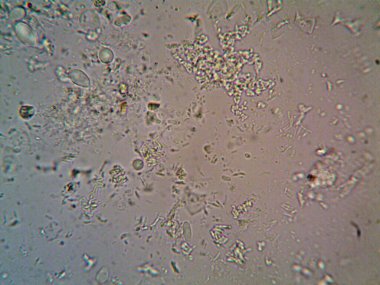 Mikroskop x100 'de görülen mikroorganizma