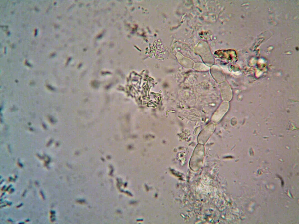Мікроорганізм Мікроскопі X100 — стокове фото