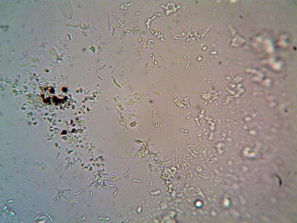 Mikroorganism Sedd Mikroskop X100 — Stockfoto