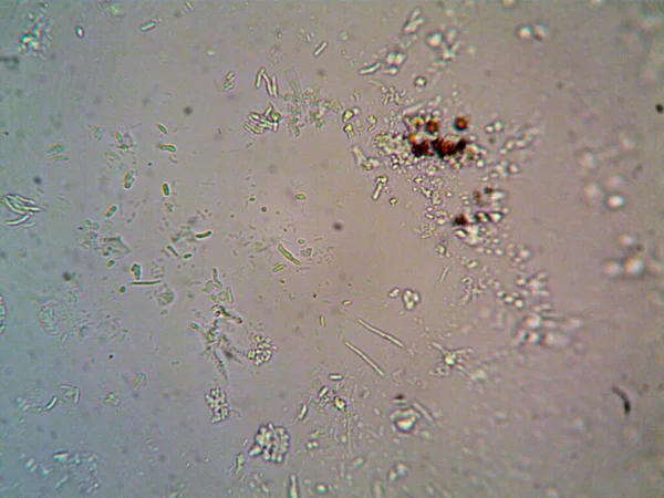 Microorganismo Visto Microscopio X100 — Foto de Stock
