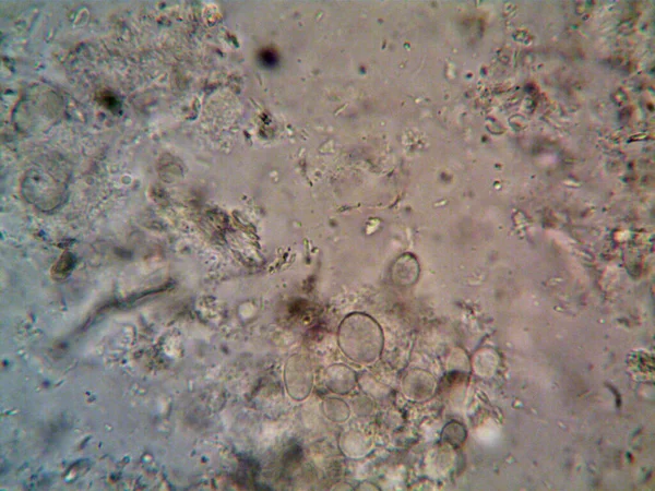 Microorganismo Visto Microscopio X100 —  Fotos de Stock