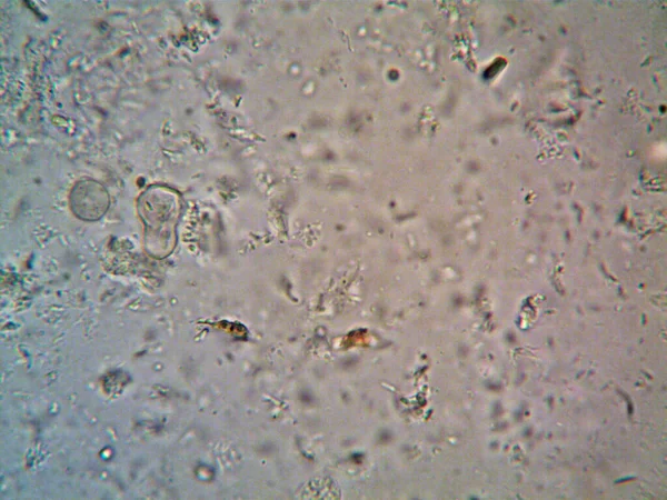 Микроорганизм Микроскопом X100 — стоковое фото