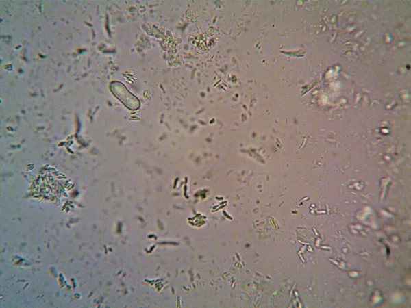 Microorganismo Visto Microscopio X100 — Foto de Stock