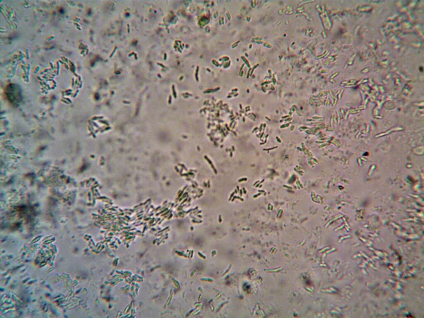 Mikroskop x100 'de görülen mikroorganizma
