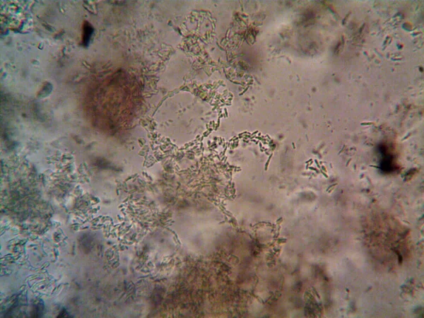 Microorganismo Observado Microscópio X100 — Fotografia de Stock