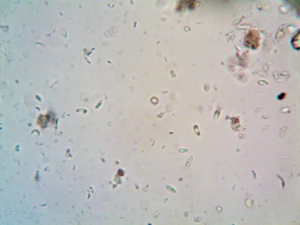 Micro Organisme Waargenomen Microscoop X100 — Stockfoto