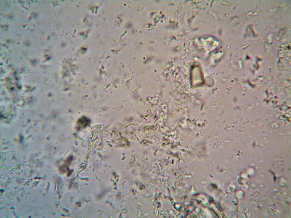 顕微鏡で見た微生物X100 — ストック写真