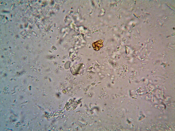 Microorganismo Observado Microscópio X100 — Fotografia de Stock