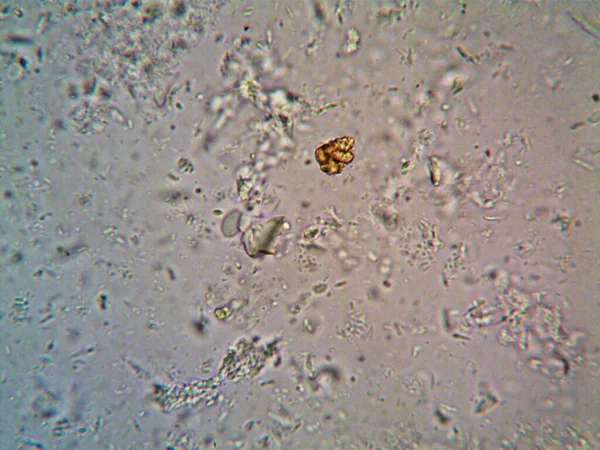 Microorganismo Visto Microscopio X100 —  Fotos de Stock