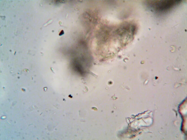 Μικροοργανισμός Στο Μικροσκόπιο X100 — Φωτογραφία Αρχείου