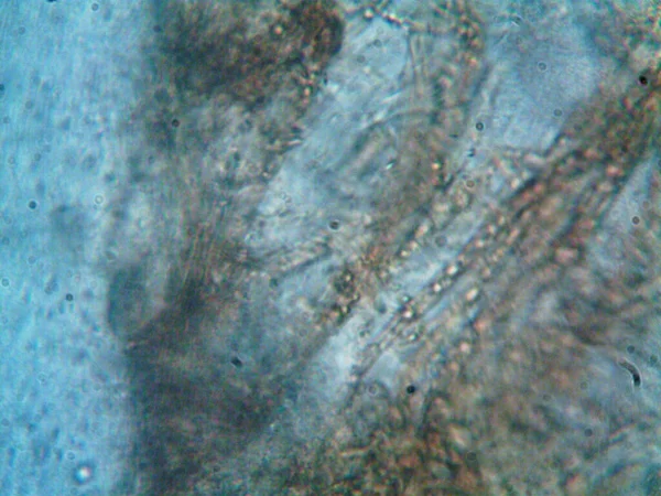 현미경으로 관찰되는 미생물 X100 — 스톡 사진