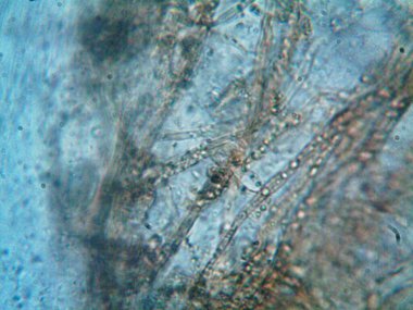 Mikroskop x100 'de görülen mikroorganizma