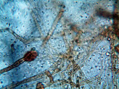 Mikroskop x100 'de görülen mikroorganizma