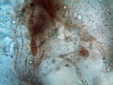 Mikroskop x100 'de görülen mikroorganizma