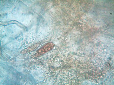 Microorganism seen in microscope x100 clipart