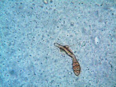 Mikroskop x100 'de görülen mikroorganizma