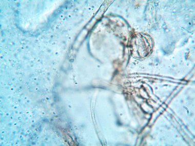 Mikroskop x100 'de görülen mikroorganizma