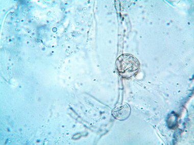 Mikroskop x100 'de görülen mikroorganizma