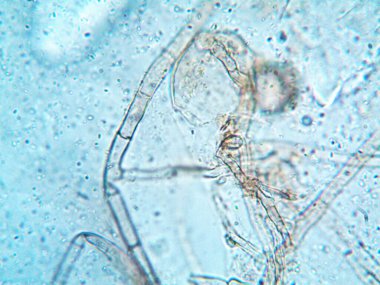 Mikroskop x100 'de görülen mikroorganizma