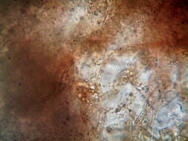 Mikroskop x100 'de görülen mikroorganizma