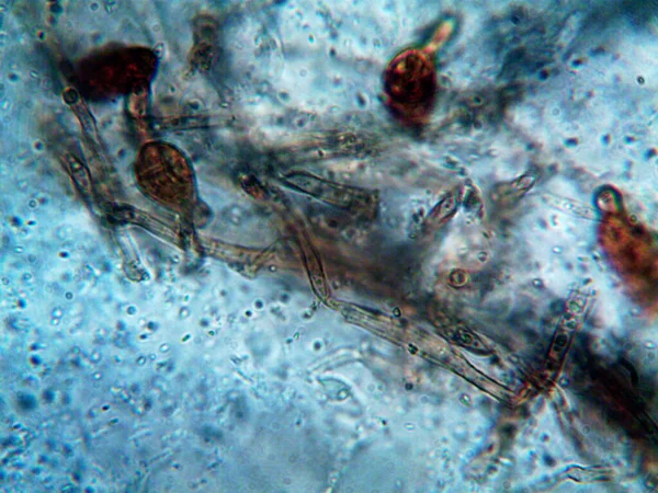 Mikroorganismen Unter Dem Mikroskop X100 — Stockfoto