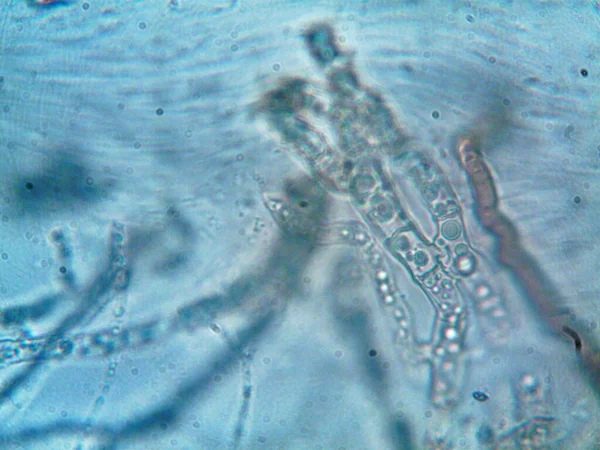 显微镜下的微生物X100 — 图库照片