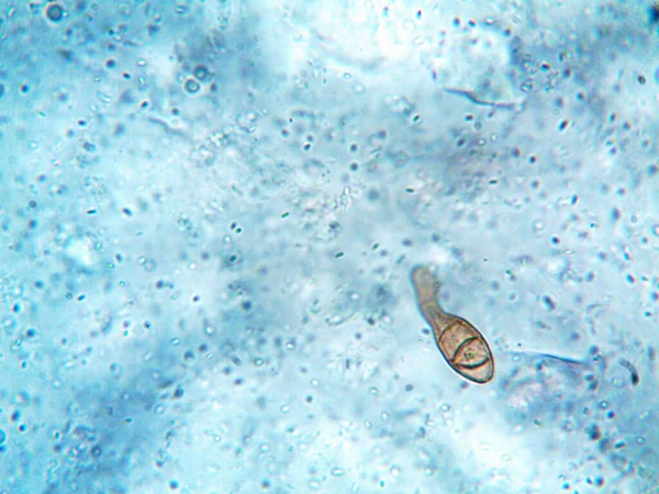 Mikroskop x100 'de görülen mikroorganizma