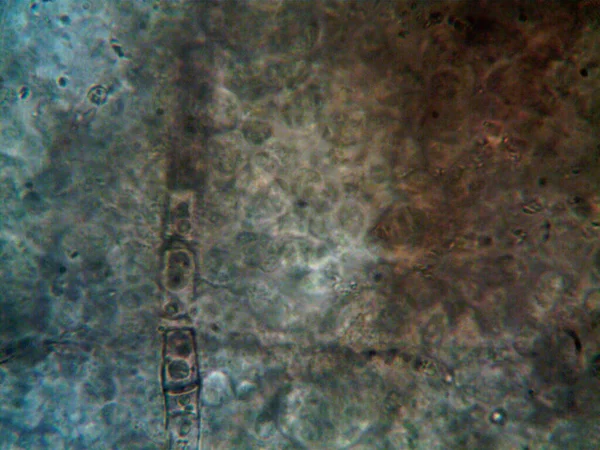 显微镜下的微生物X100 — 图库照片