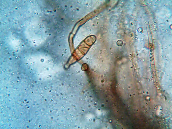 Mikroorganismen Unter Dem Mikroskop X100 — Stockfoto