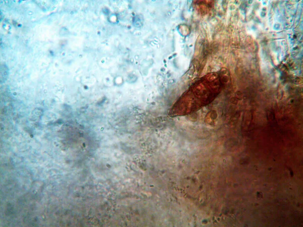 Microorganismo Visto Microscopio X100 — Foto de Stock