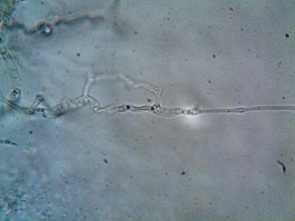 Microorganismo Visto Microscopio X100 —  Fotos de Stock