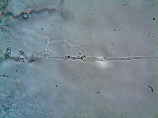 Mikroskop X100 Görülen Mikroorganizma — Stok fotoğraf
