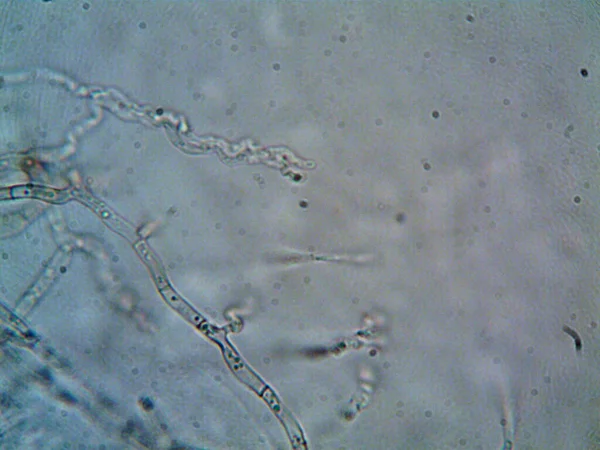 Microorganismo Visto Microscopio X100 —  Fotos de Stock