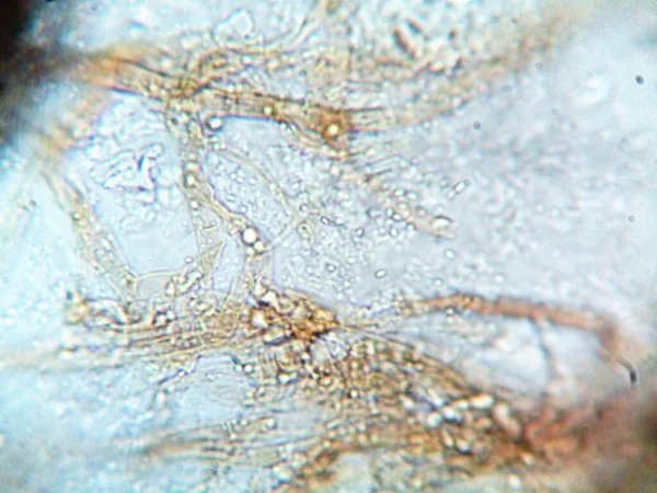Microorganisme Microscope X100 — Photo